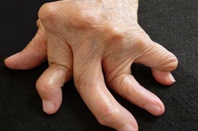 北京万岁中医院_灵气治病_美容减肥长寿_高血压高血脂高血糖_脑梗脑溢血_近视肥胖痴呆_头疼失眠_病毒肝炎_病毒感冒_肿瘤癌症