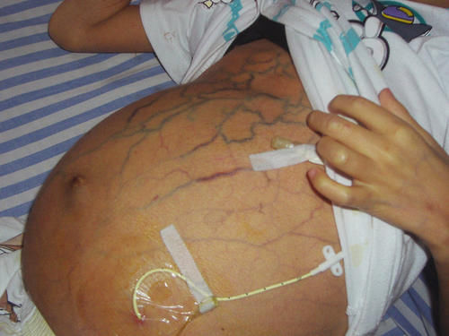 北京万岁中医院_灵气治病_美容减肥长寿_高血压高血脂高血糖_脑梗脑溢血_近视肥胖痴呆_头疼失眠_病毒肝炎_病毒感冒_肿瘤癌症