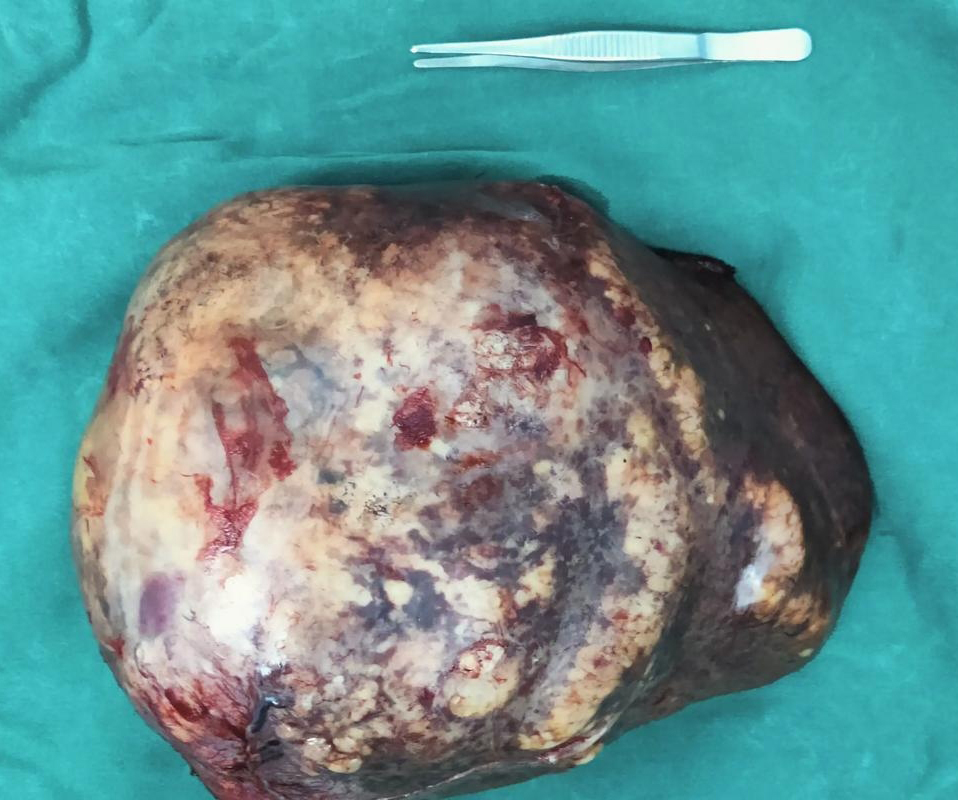 北京万岁中医院_灵气治病_美容减肥长寿_高血压高血脂高血糖_脑梗脑溢血_近视肥胖痴呆_头疼失眠_病毒肝炎_病毒感冒_肿瘤癌症