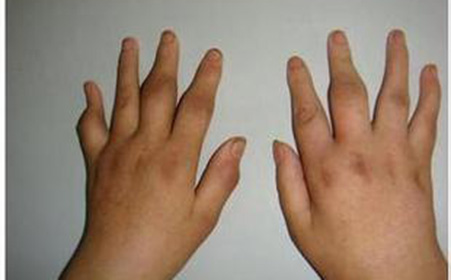 北京万岁医院_灵气治病_美容减肥长寿_高血压高血脂高血糖_脑梗脑溢血_近视肥胖痴呆_头疼失眠_病毒肝炎_病毒感冒_肿瘤癌症