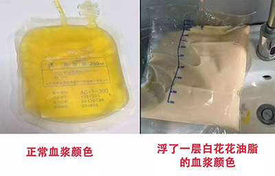 北京万岁医院_灵气治病_美容减肥长寿_高血压高血脂高血糖_脑梗脑溢血_近视肥胖痴呆_头疼失眠_病毒肝炎_病毒感冒_肿瘤癌症