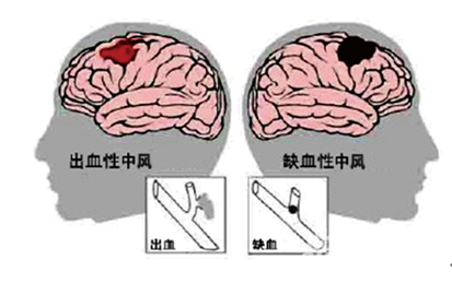 北京万岁医院_灵气治病_美容减肥长寿_高血压高血脂高血糖_脑梗脑溢血_近视肥胖痴呆_头疼失眠_病毒肝炎_病毒感冒_肿瘤癌症