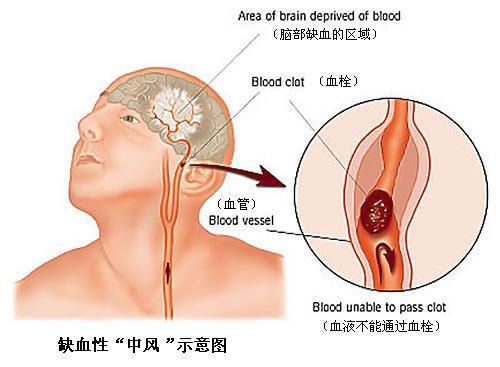 北京万岁医院_灵气治病_美容减肥长寿_高血压高血脂高血糖_脑梗脑溢血_近视肥胖痴呆_头疼失眠_病毒肝炎_病毒感冒_肿瘤癌症