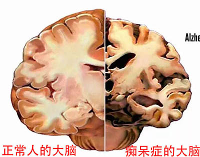 北京万岁医院_灵气治病_美容减肥长寿_高血压高血脂高血糖_脑梗脑溢血_近视肥胖痴呆_头疼失眠_病毒肝炎_病毒感冒_肿瘤癌症